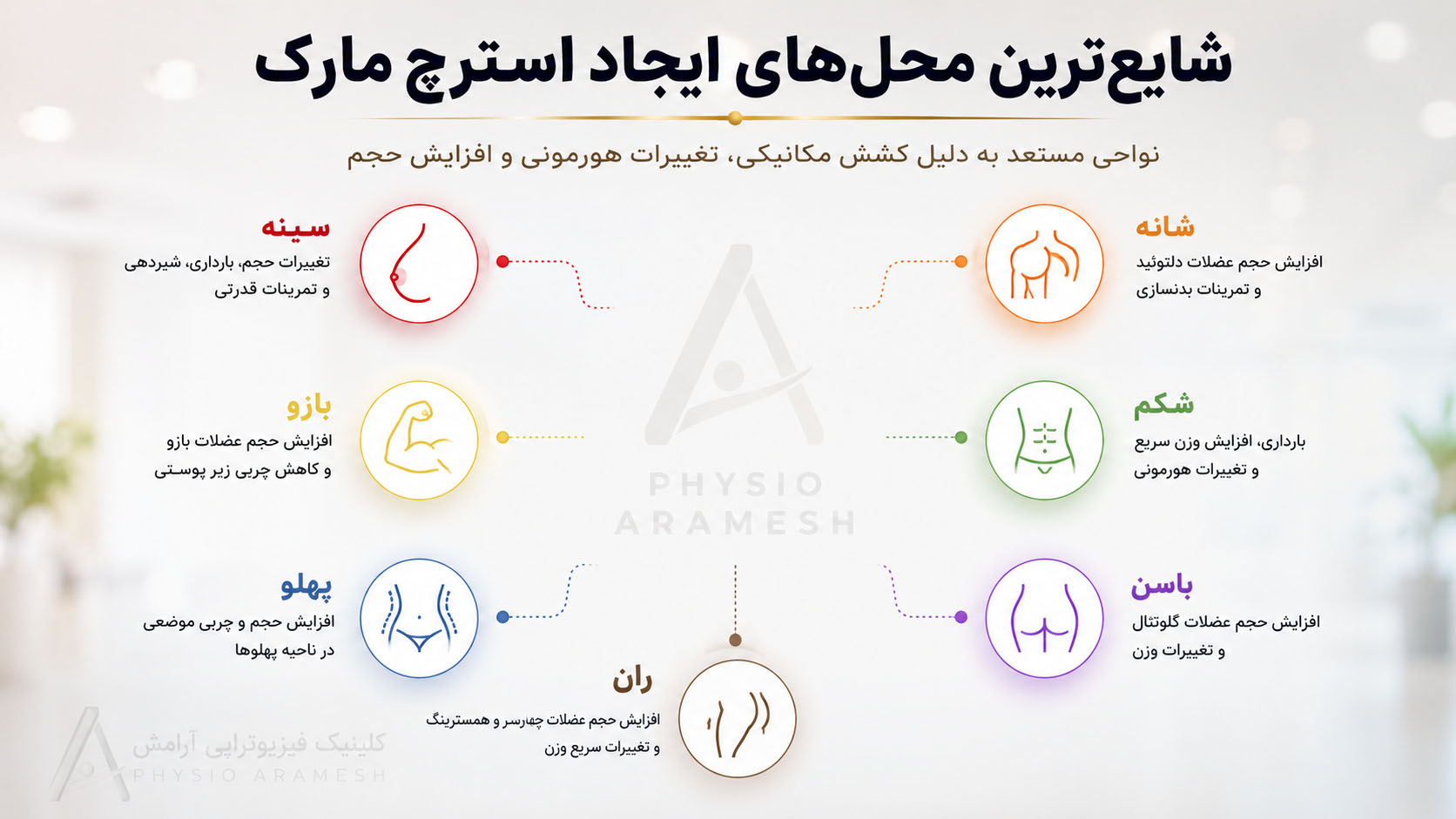 نواحی رایج ایجاد استرچ مارک در بدن